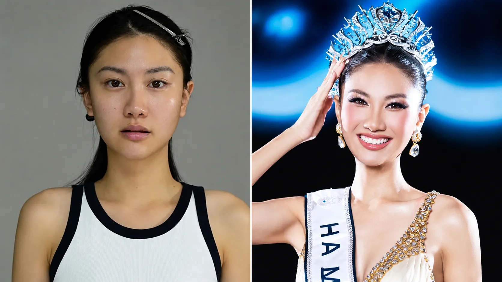 Bác sĩ Lê Hải Đăng đồng hành cùng Hoa hậu Phương Linh