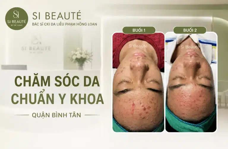 Địa Chỉ Chăm Sóc Da Chuẩn Y Khoa Quận Bình Tân