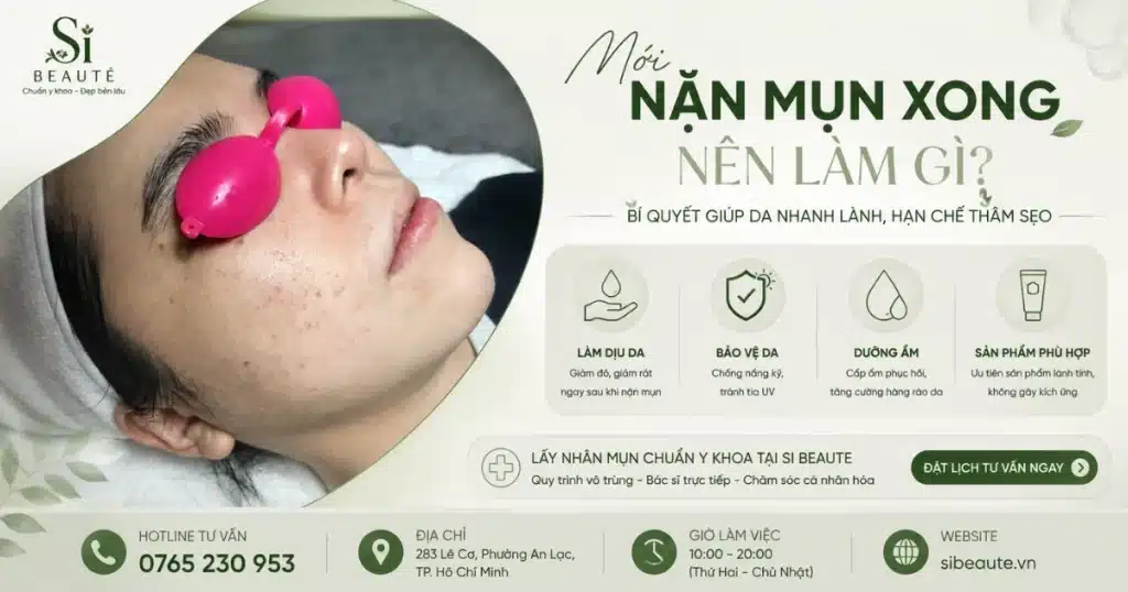 mới nặn mụn xong nên làm gì