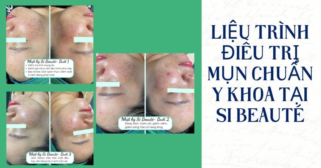 Thẩm Mỹ Viện Uy Tín Quận Bình Tân