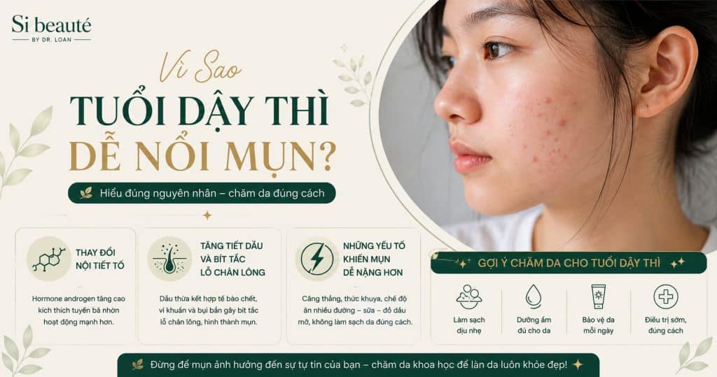 Vì Sao Tuổi Dậy Thì Dễ Nổi Mụn?