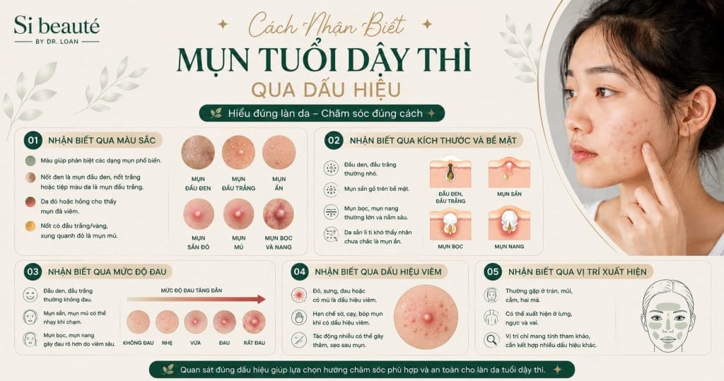 Cách Nhận Biết Mụn Tuổi Dậy Thì Qua Dấu Hiệu
