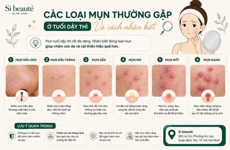 Các Loại Mụn Thường Gặp Ở Tuổi Dậy Thì Và Cách Nhận Biết