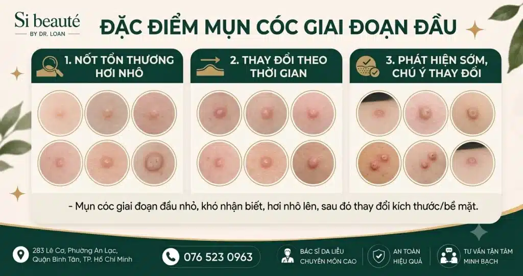 Mụn Cóc Giai Đoạn Đầu Có Đặc Điểm Gì?