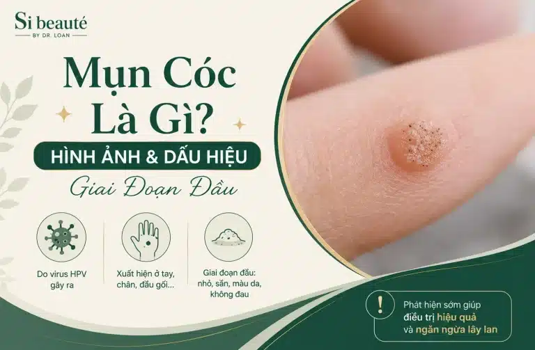 Mụn Cóc Là Gì? Hình Ảnh Và Dấu Hiệu Giai Đoạn Đầu