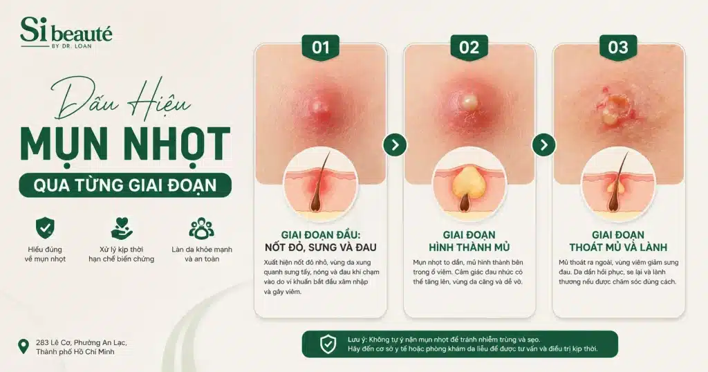 Dấu Hiệu Mụn Nhọt Qua Từng Giai Đoạn