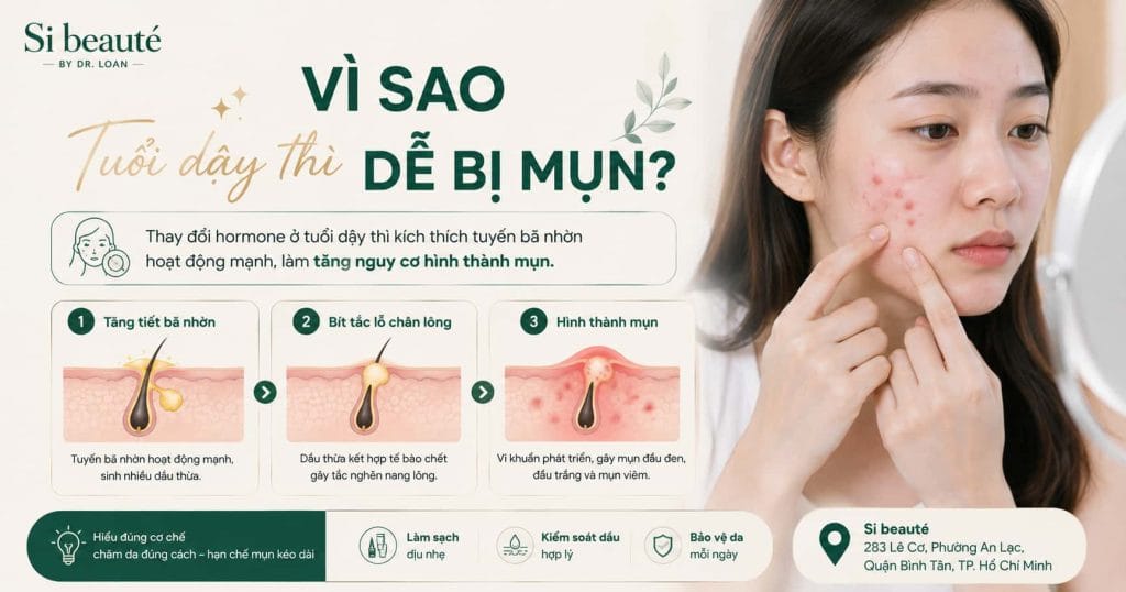 Vì Sao Tuổi Dậy Thì Dễ Bị Mụn?