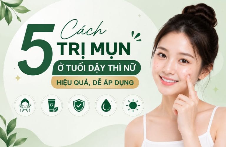 5 cách trị mụn ở tuổi dậy thì nữ hiệu quả, dễ áp dụng