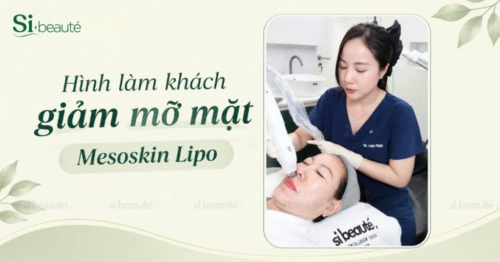 Hình làm khách giảm mỡ mặt - mesoskin lipo