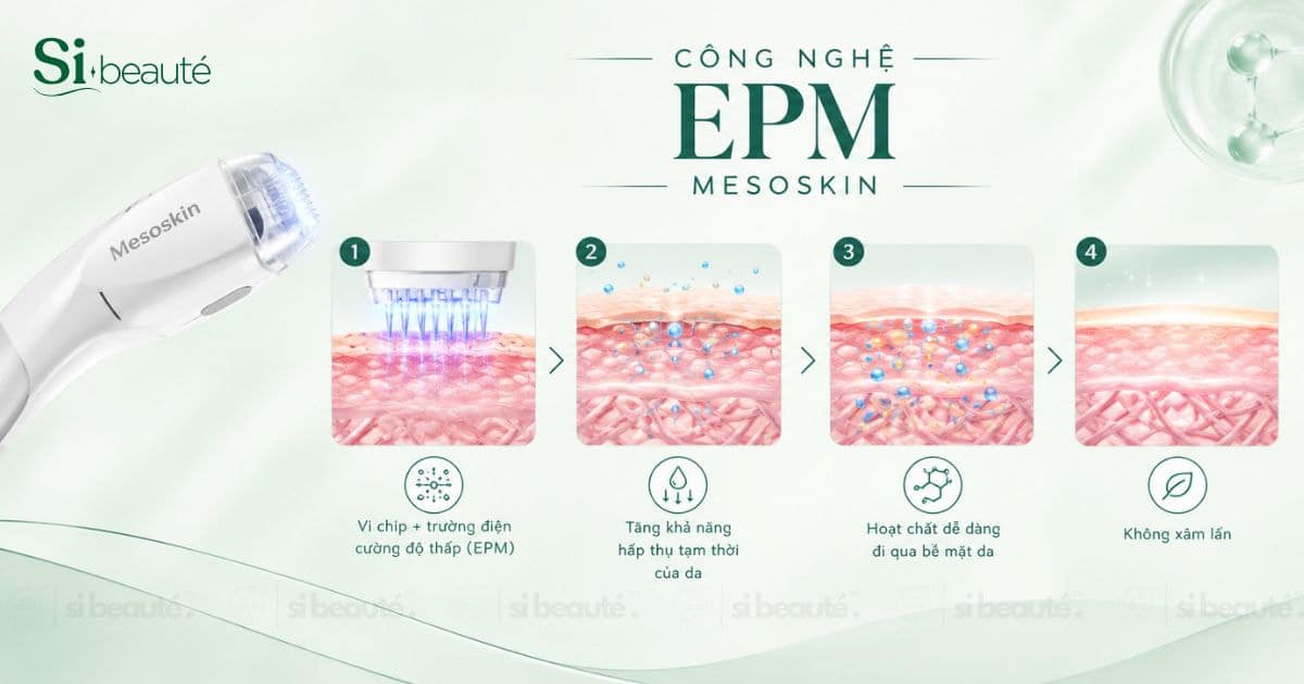 cơ chế hoạt động của máy mesoskin