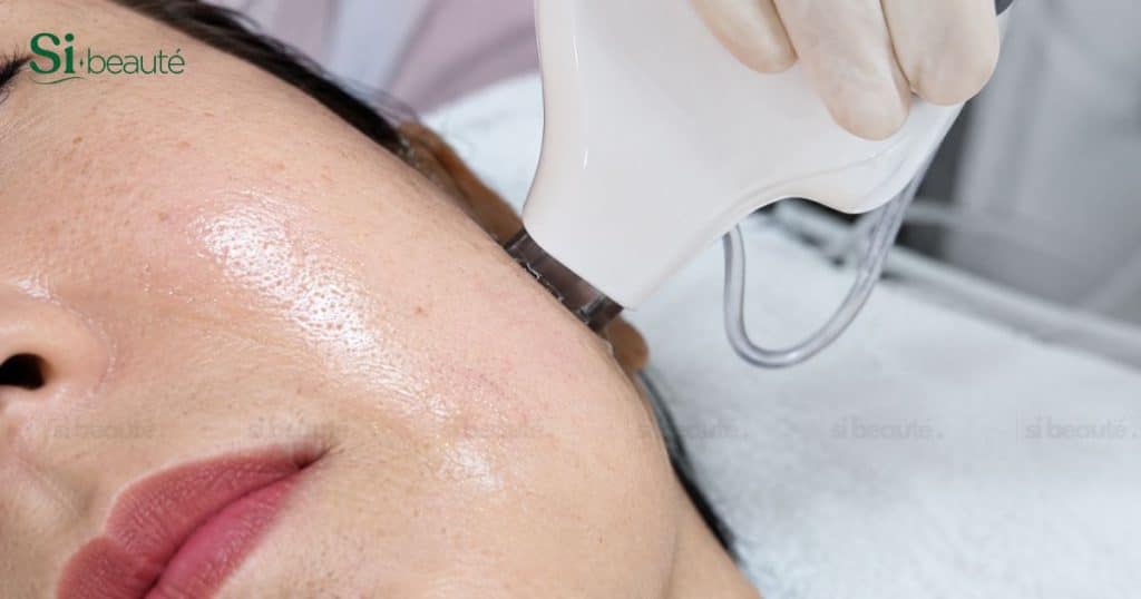 Hình làm khách giảm mỡ nọng cằm bằng máy mesoskin